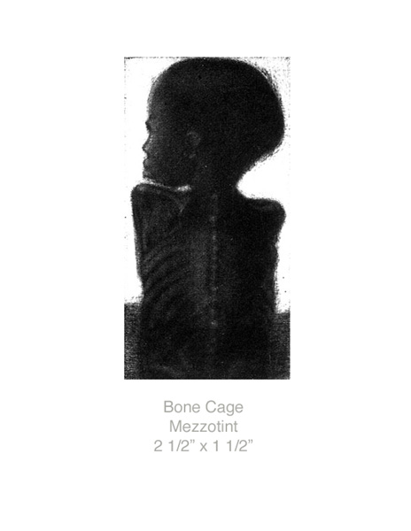 Bone Cage-gallery